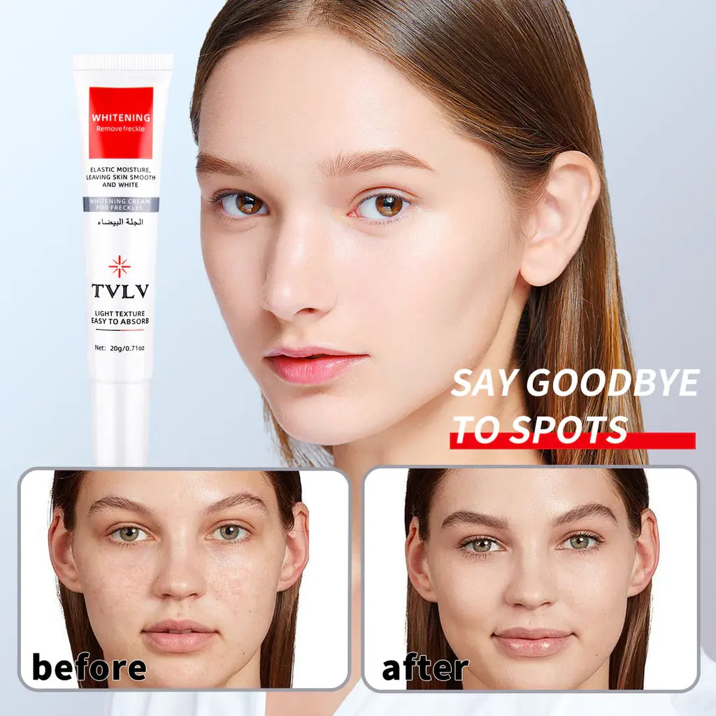 TVLV Freckles Cream 去雀斑霜